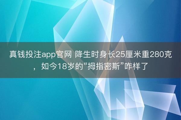 真钱投注app官网 降生时身长25厘米重280克,如今18岁的“拇指密斯”咋样了