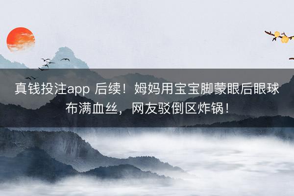 真钱投注app 后续!姆妈用宝宝脚蒙眼后眼球布满血丝,网友驳倒区炸锅!